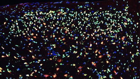 Epigenetic Factor at the Origin of Chronic Pain Identified