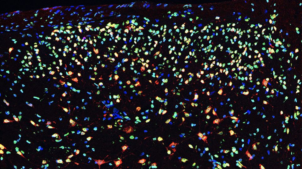 Epigenetic Factor at the Origin of Chronic Pain Identified content piece image