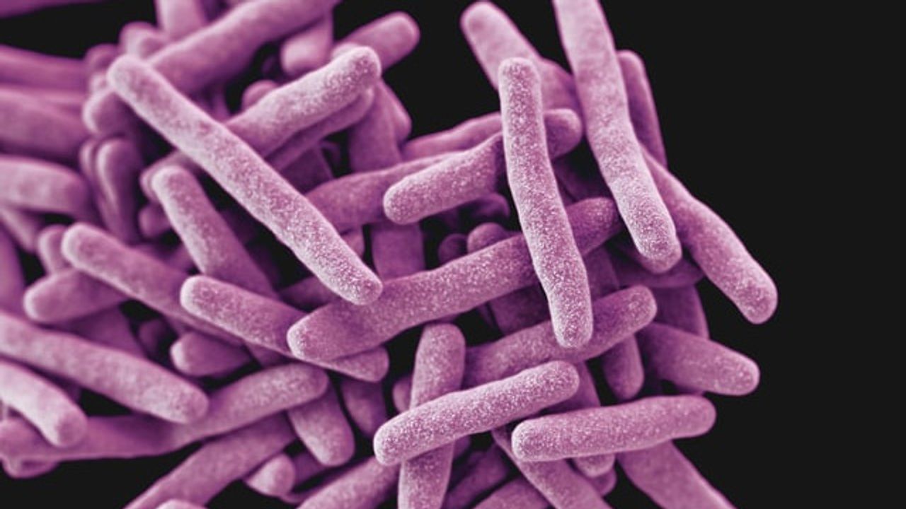 Ancient DNA Reveals Early TB Variants Traveled Long Distances on Land