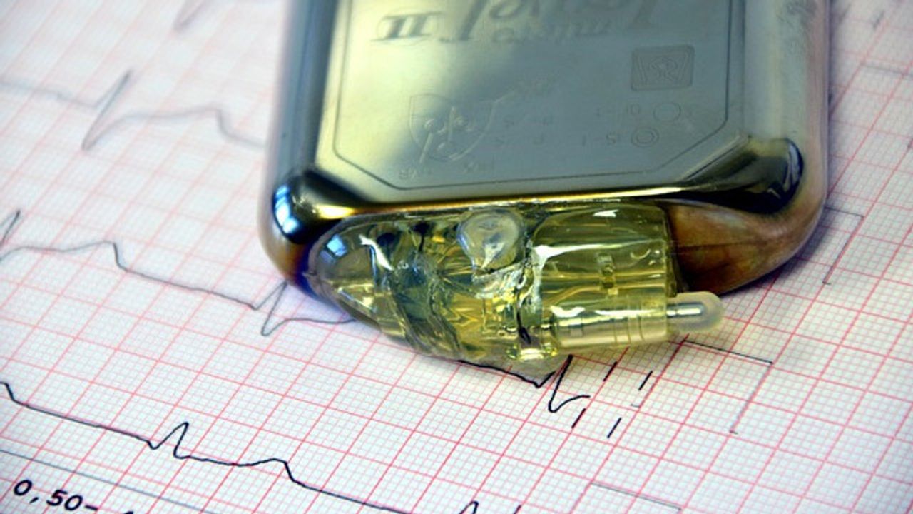Incorporating Anti-Inflammatory Drugs Into the Coating of Implants To Reduce Reactions