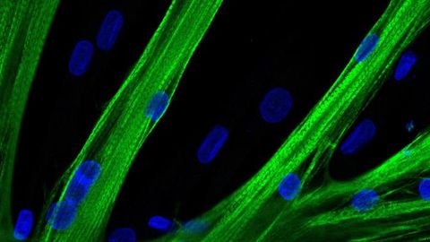 mRNA Delivery of CRISPR-Cas 9 Tool To Improve Muscle Strength
