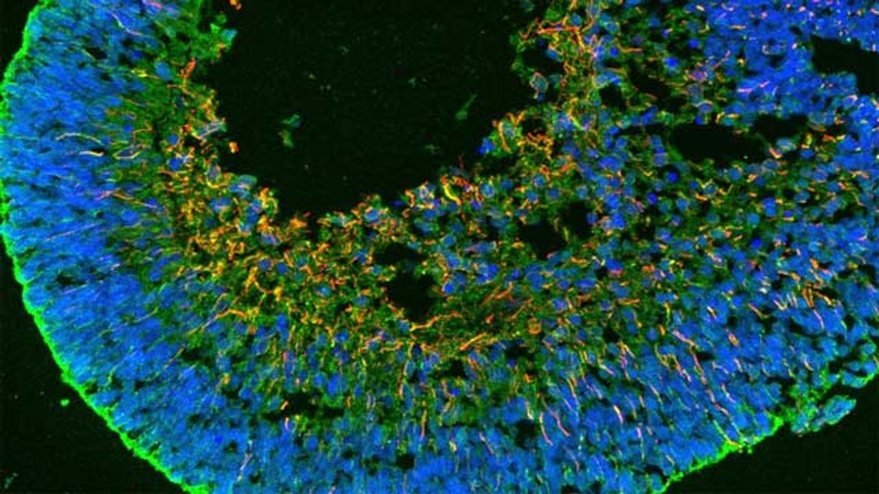 Cell Fusion "Awakens" Regenerative Potential of Human Retina