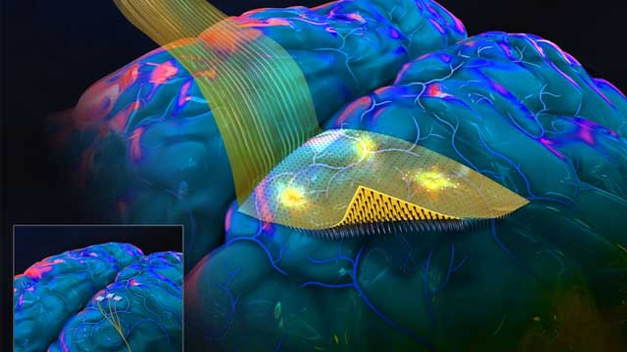 Flexible Microneedles Could Advance Brain Implants