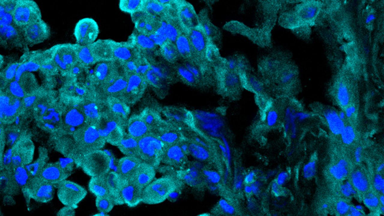 Enhancing the Antitumor Immune Response By Blocking Enzyme ART1