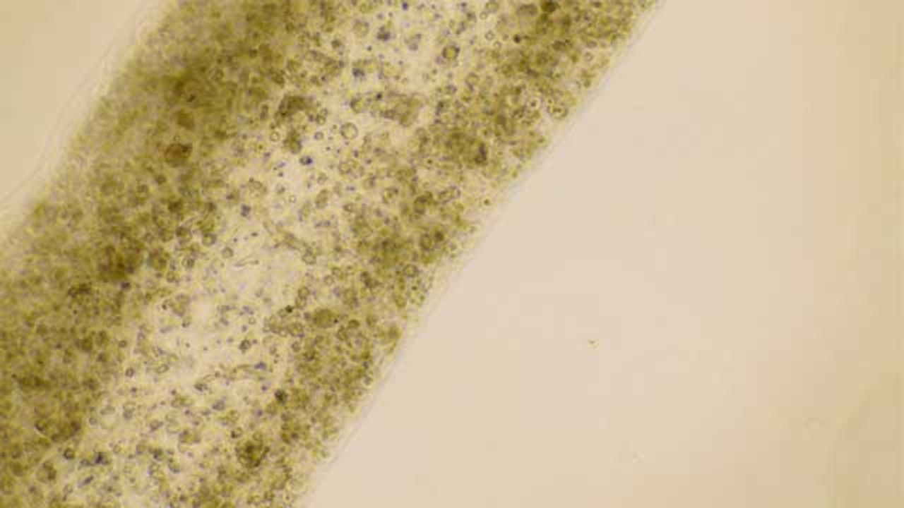 Human Testicular Cells Successfully 3D Printed