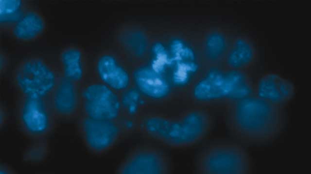 Tackling Cancer by Stabilizing Chromosomes