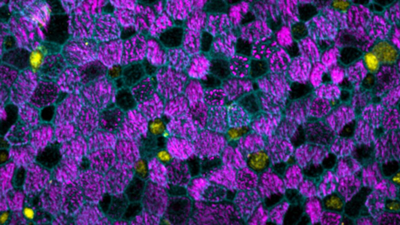 New Method Simplifies Lung Organoid Generation