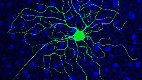 Alcoholism Drug May Revive Vision in Progressive Blindness Disorder, Suggests Mouse Study