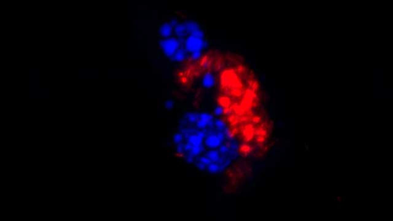 Anti-Malaria Drugs Can Also Fight Non-Tuberculous Mycobacteria Infections