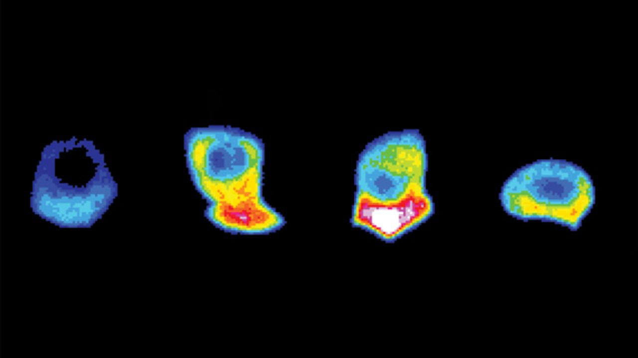 How Invading Cancer Cells Amass and Deploy Fuel to the “Front Line”