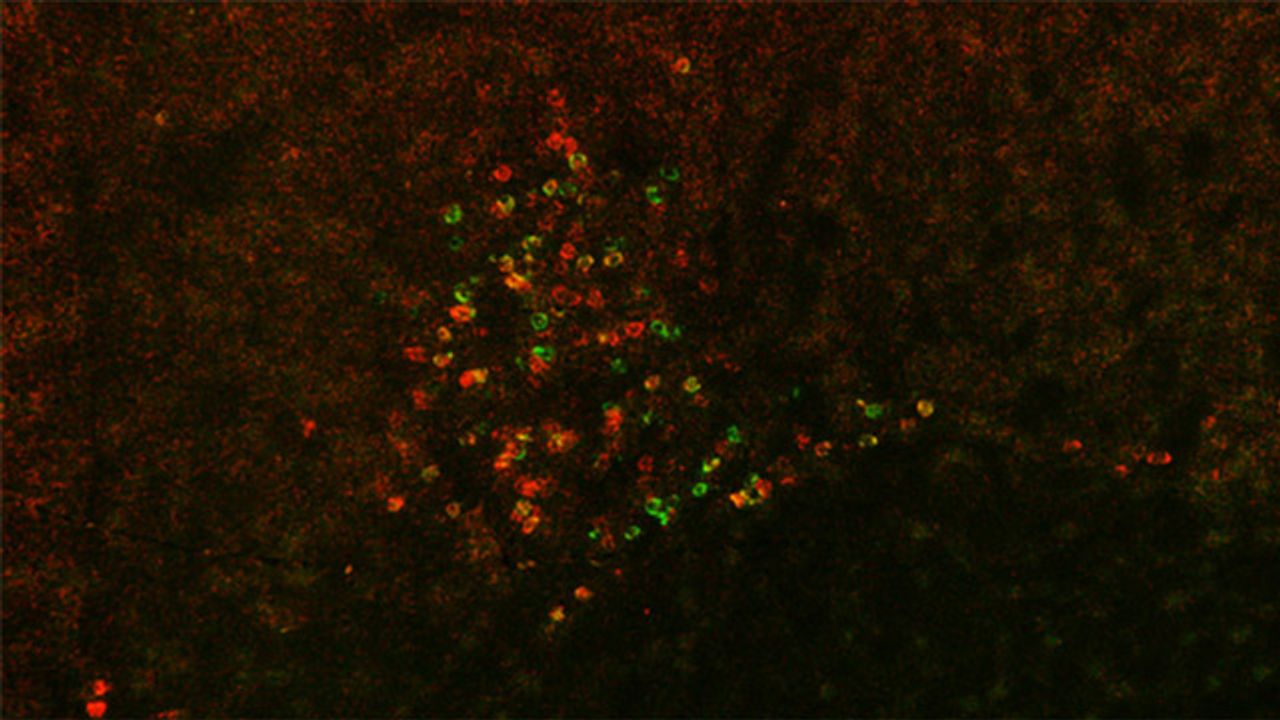 The Hunt for a Brain Circuit That Induces Alcohol Withdrawal