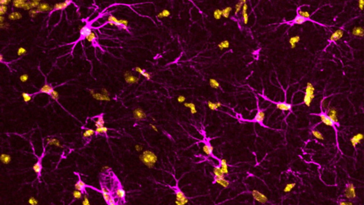Astrocytes