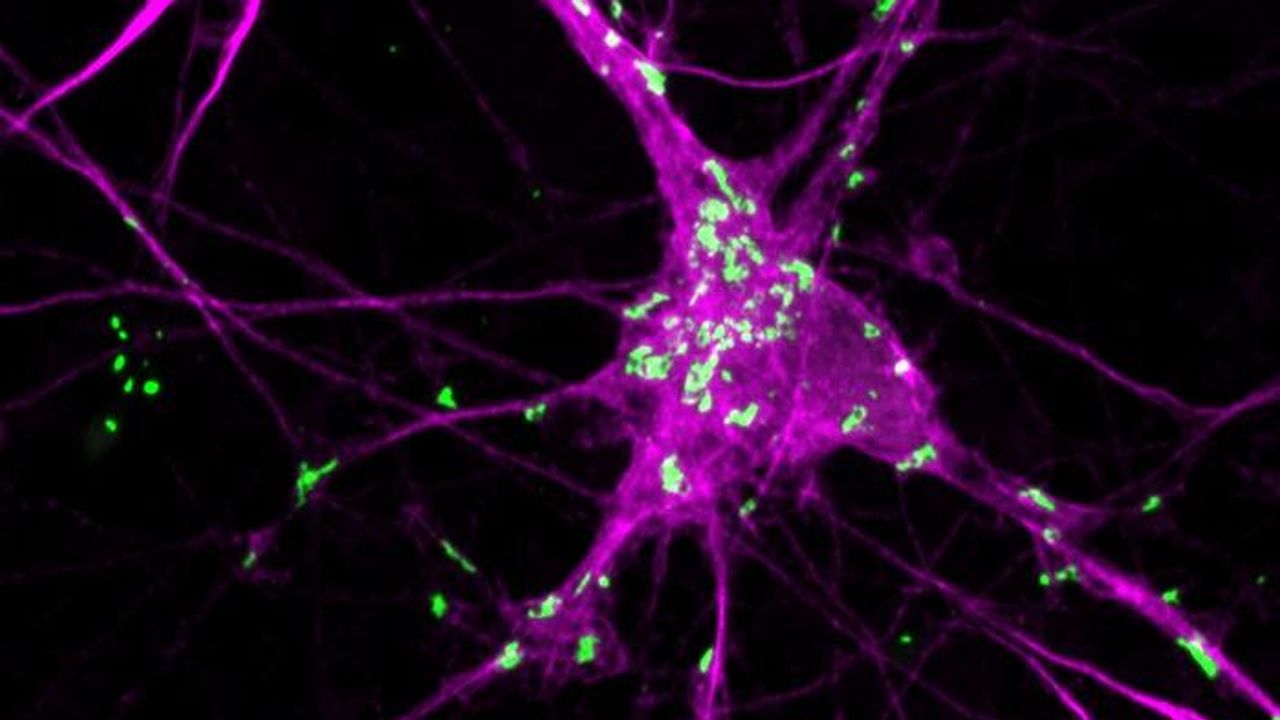 New System Allows Control Over Spread of Parkinson's Protein