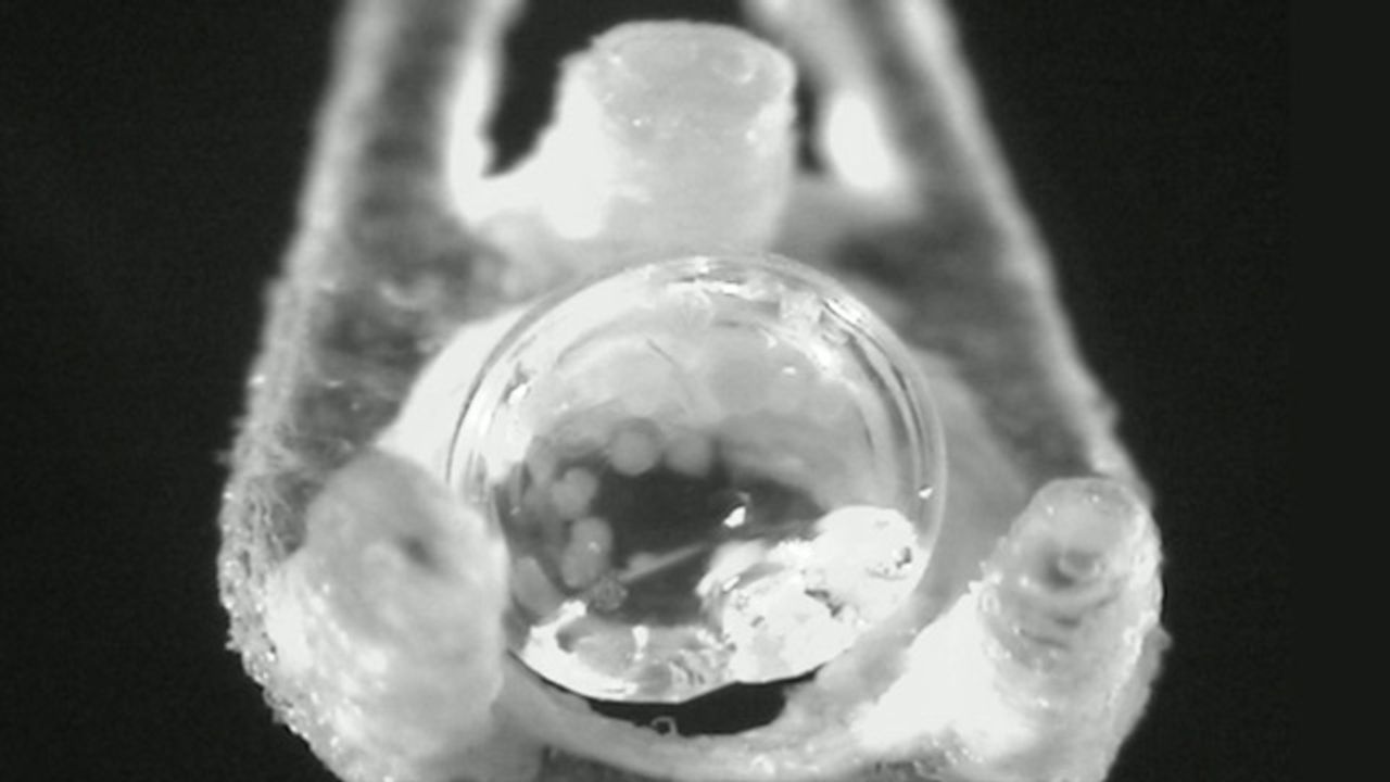 New Method of Pancreatic Islet Cryopreservation Developed