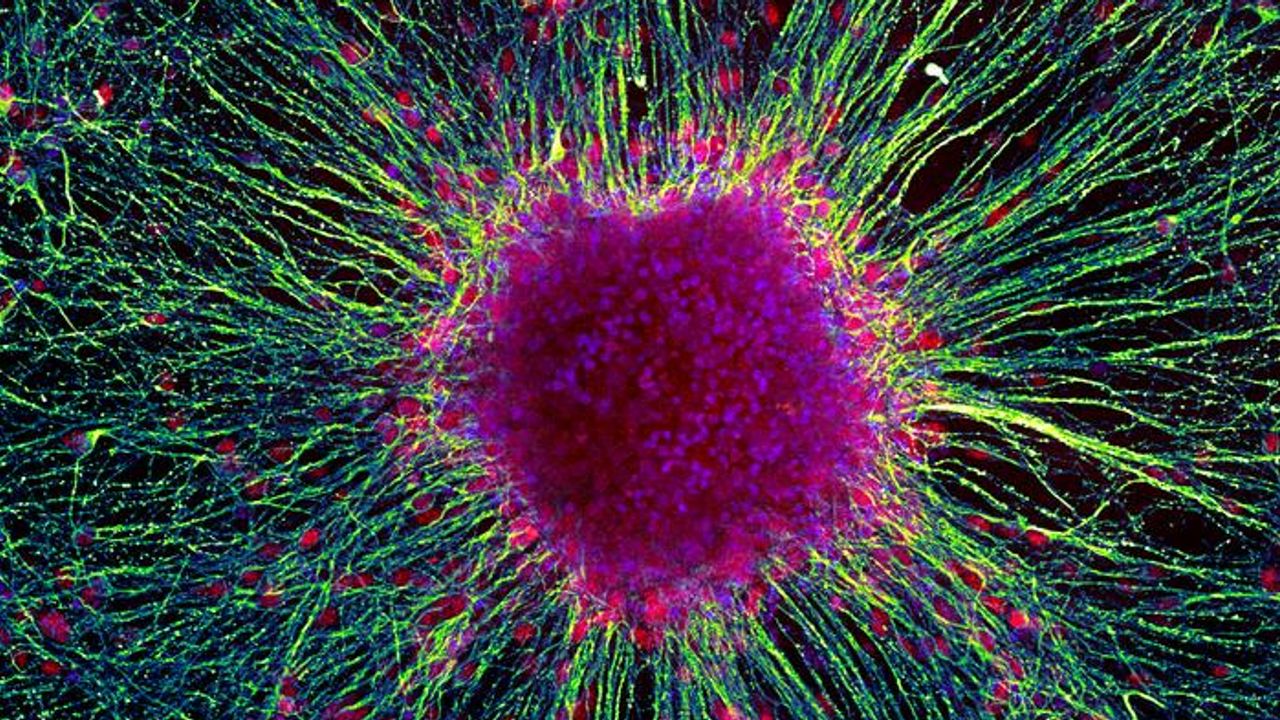 Genetic "Dimmer Switch" Can Control Human Brain Cell Growth