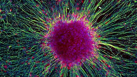 Genetic "Dimmer Switch" Can Control Human Brain Cell Growth