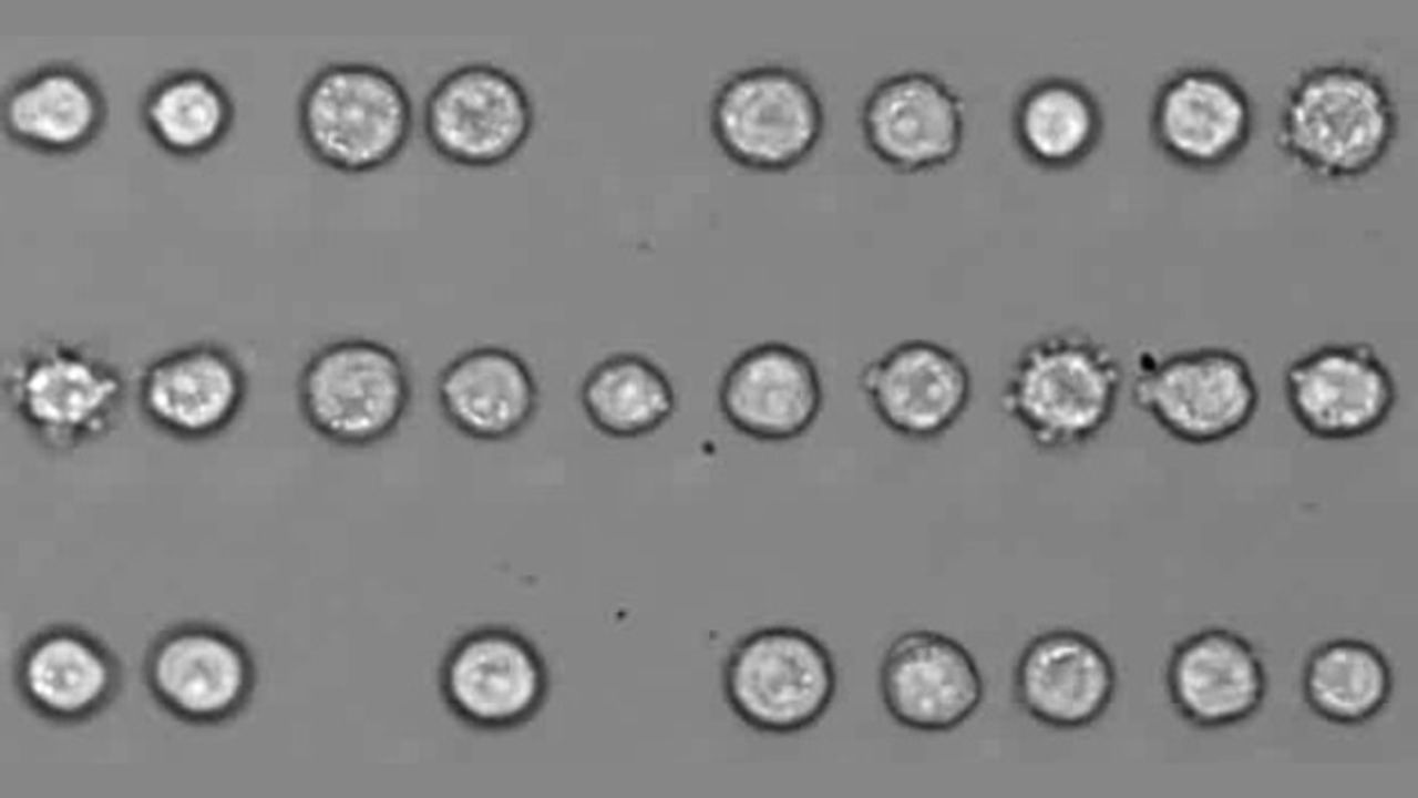 Acoustic Tweezers That Manipulate Cells Could Enable Personalized Cancer Therapies