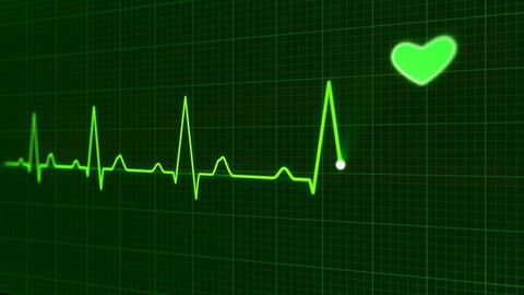 Algorithm Makes It Possible To Identify People by Their Heartbeat
