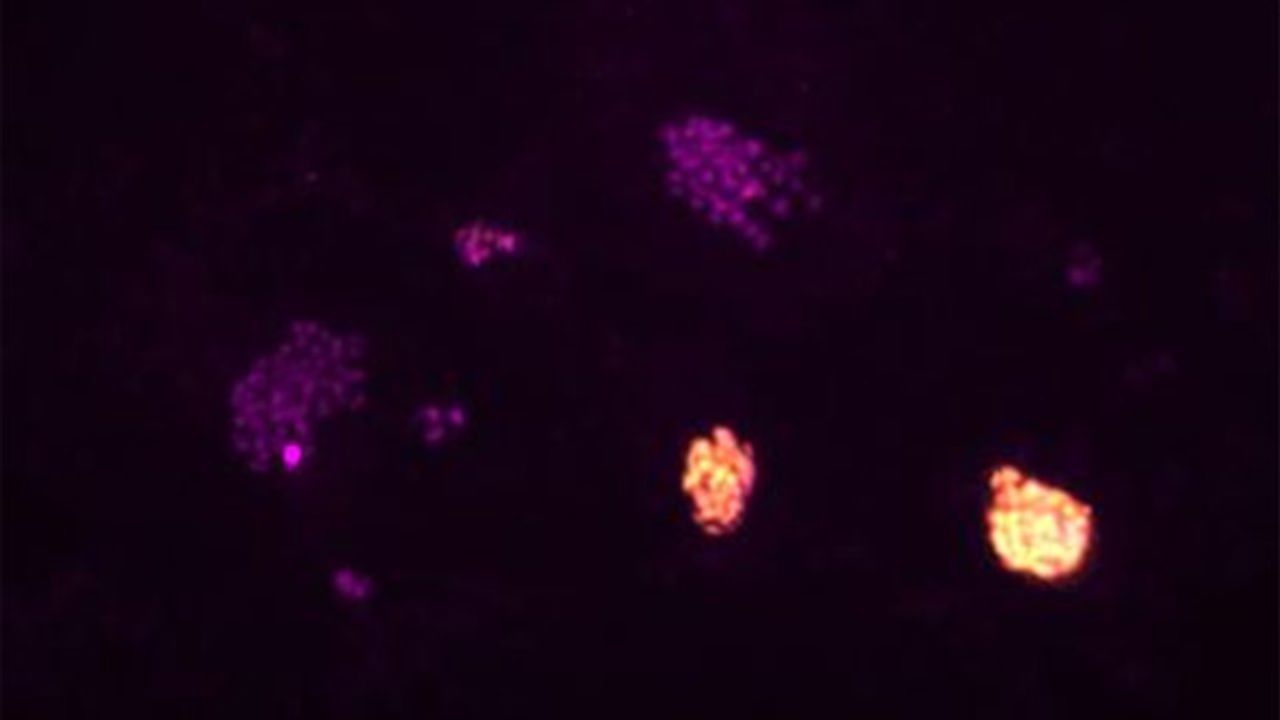 Key Factors That Promote Human Stem Cell Reprogramming Identified