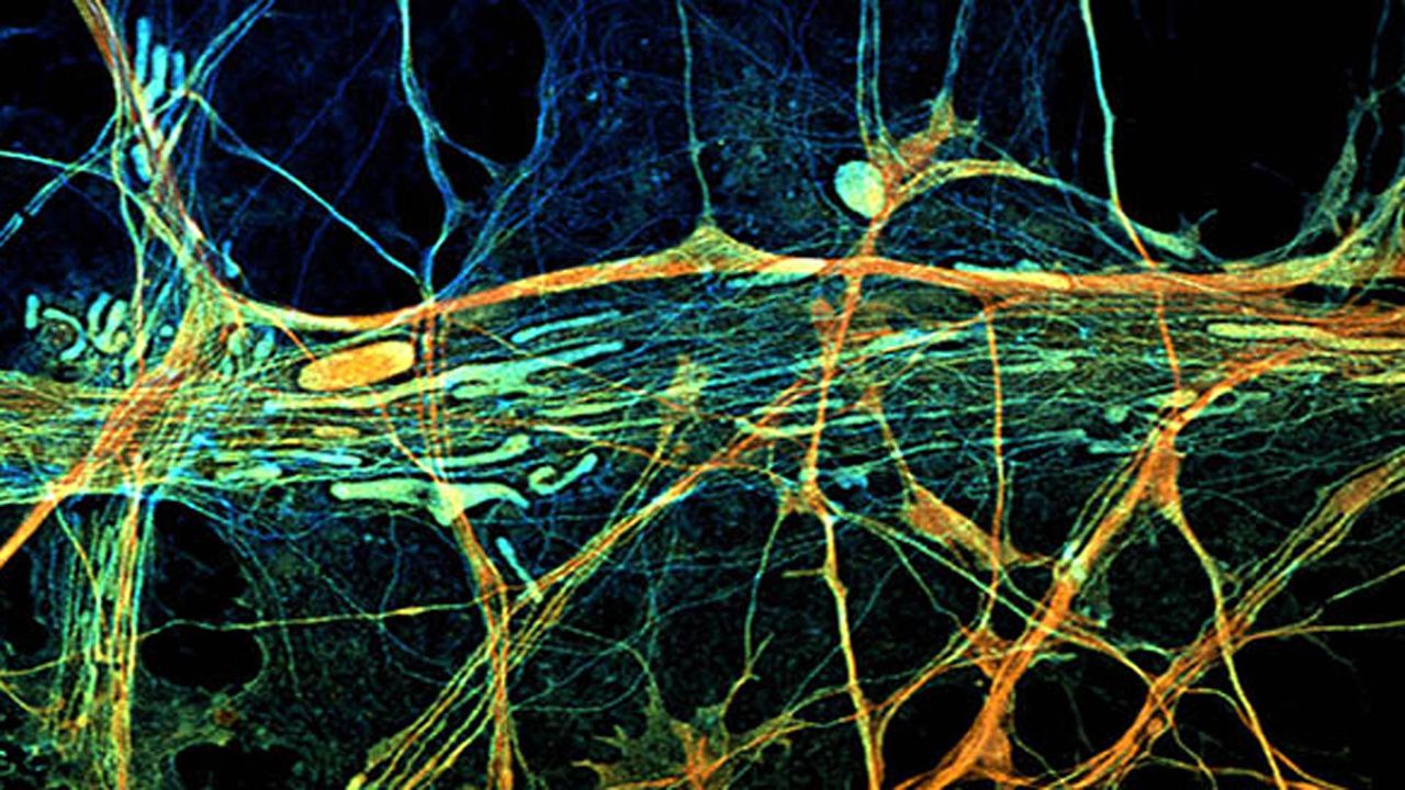 Restricting Energy in Neurons Can Make Epilepsy Worse