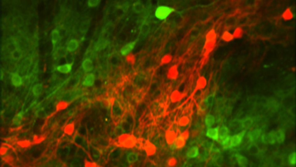 Study Identifies the Neurons That Encode Risks and Benefits content piece image