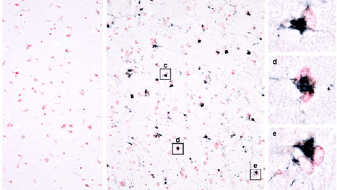 Protein Folds Into Alzheimer's-Linked Structures, But With No Link to Disease