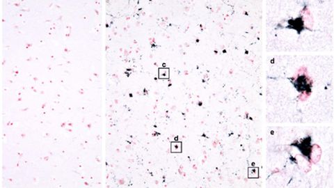 Protein Folds Into Alzheimer's-Linked Structures, But With No Link to Disease