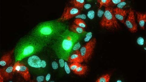 Hepatitis C and E Won't Share When It Comes to Hosts