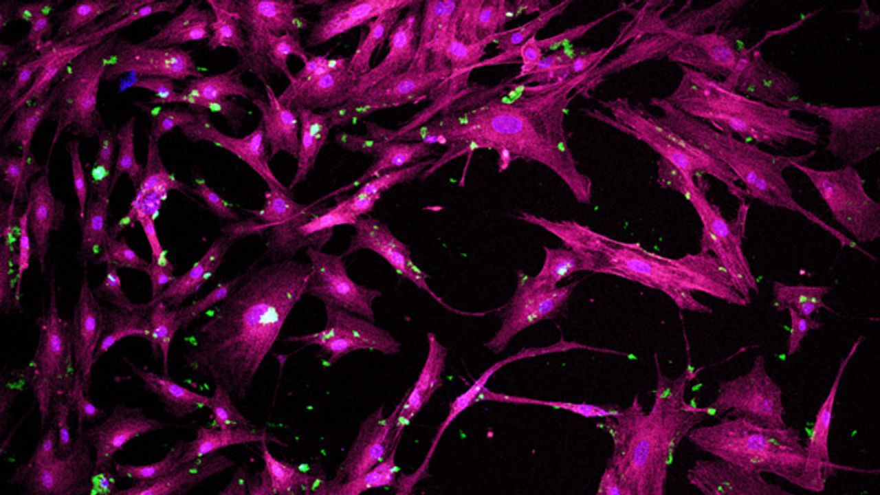 New Nanotechnology Directs Stem Cells To Form Bone Tissue
