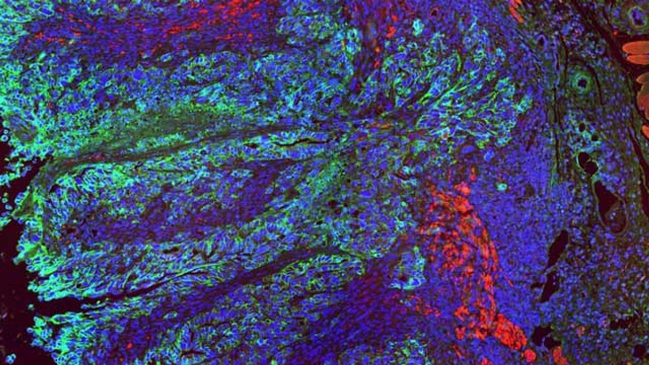Potential Protein Targets for New Immunotherapies Against Colon Cancer