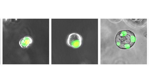 New Cell Type With Regenerative Properties Discovered in Human Lung