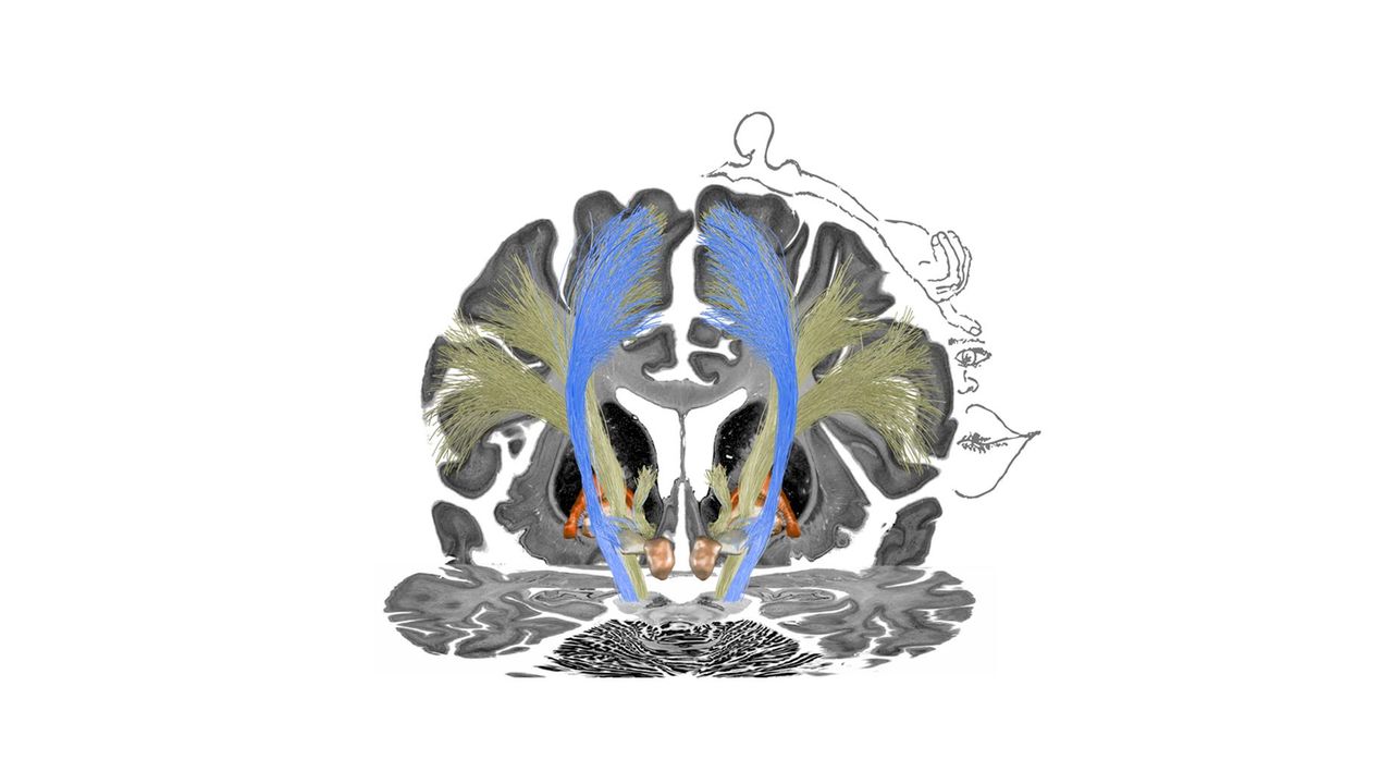 Deep Brain Stimulation Advance Could Improve Movement Disorder Treatment