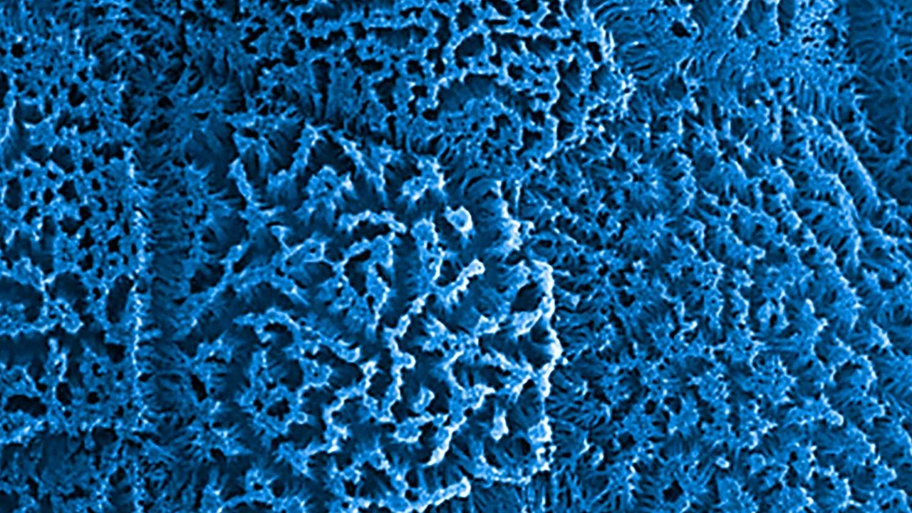 Creating a More Human-Relevant Model of the Small Intestine with Organ-Chip Technology