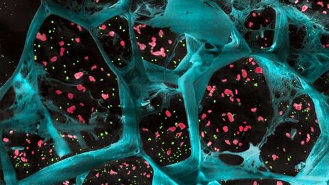 Biodegradable Gel Improves the Immune System’s Ability To Attack Cancer