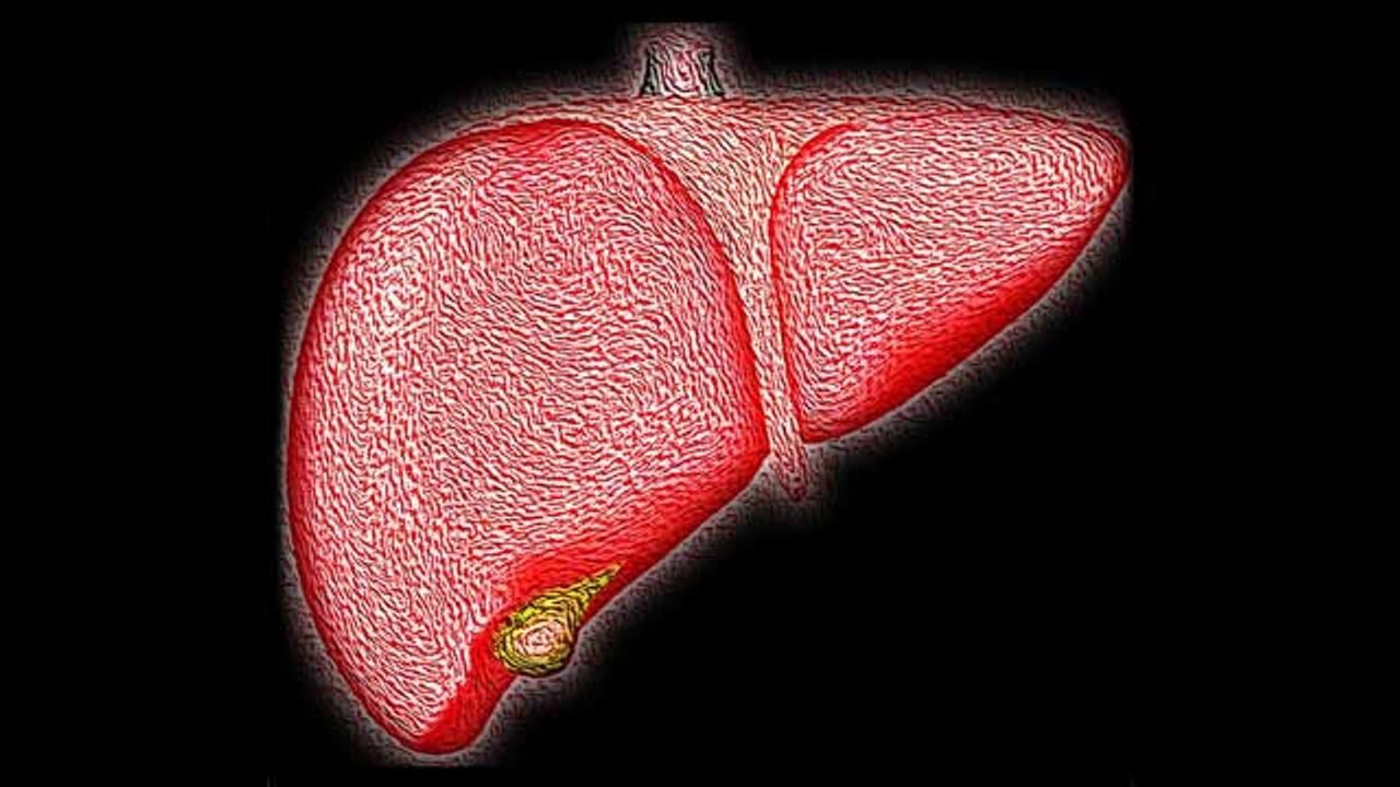 Kisspeptin Hormone Reduces Liver Damage in Mouse Model of NAFLD