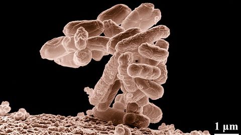 How Drug-Resistant Bacteria Build Their Protective Shield