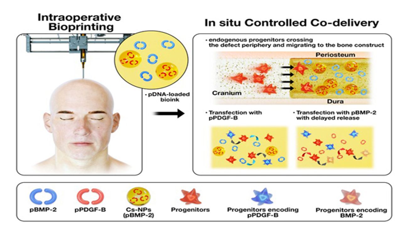 Bone Repair via Bioprinting Improved by Gene Delivery
