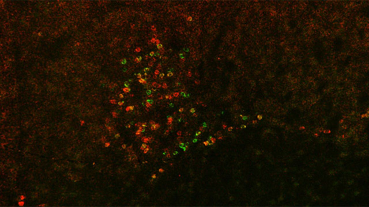 Molecule Related to Alcohol Dependence and Withdrawal