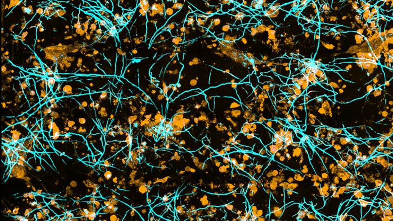 Chip Model Allows Us To See How Fungal Infections Spread in the Human Lung