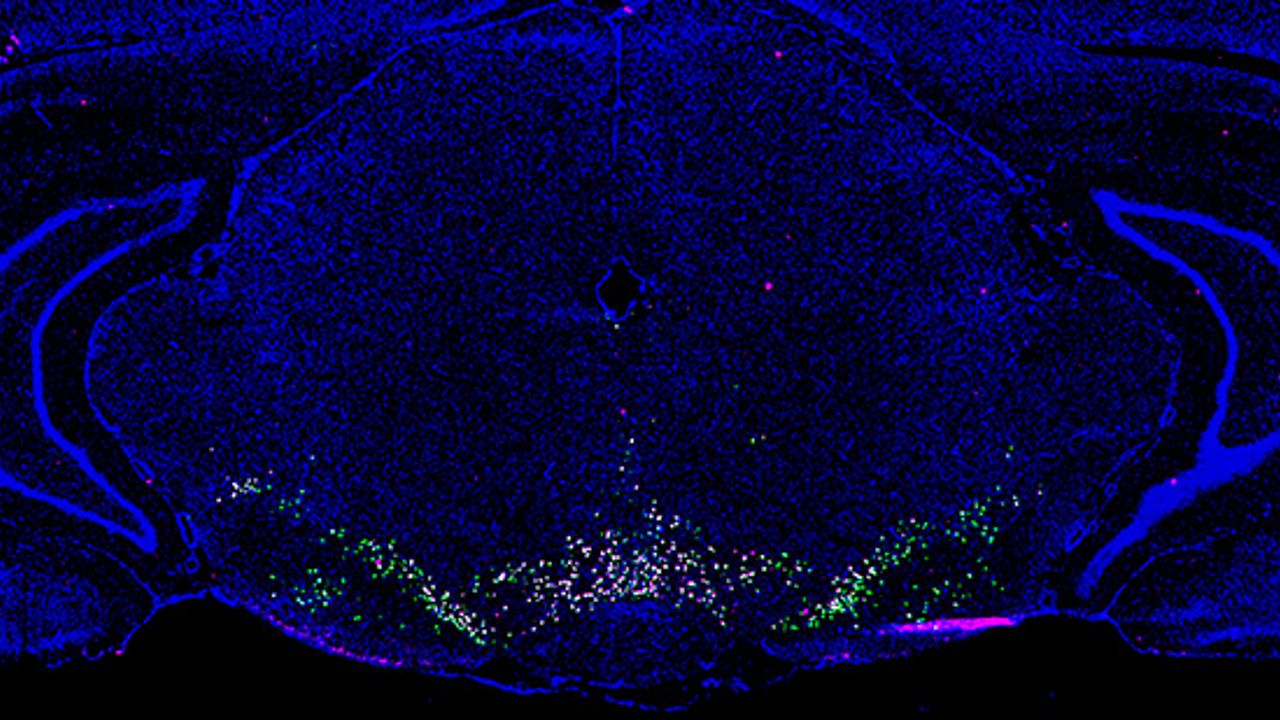 Brain Region Linked to Substance Abuse Mapped by New Atlas
