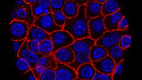 Team Tests Novel Therapy Designed To Treat Metastasis in Pancreatic Cancer