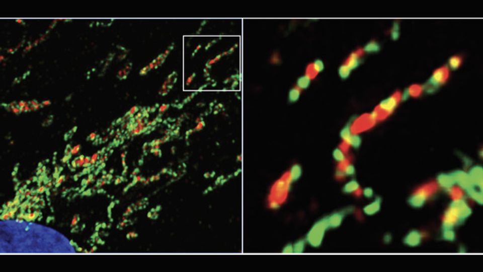 Lipid Balance Can Impact Recycling of Damaged Mitochondria content piece image