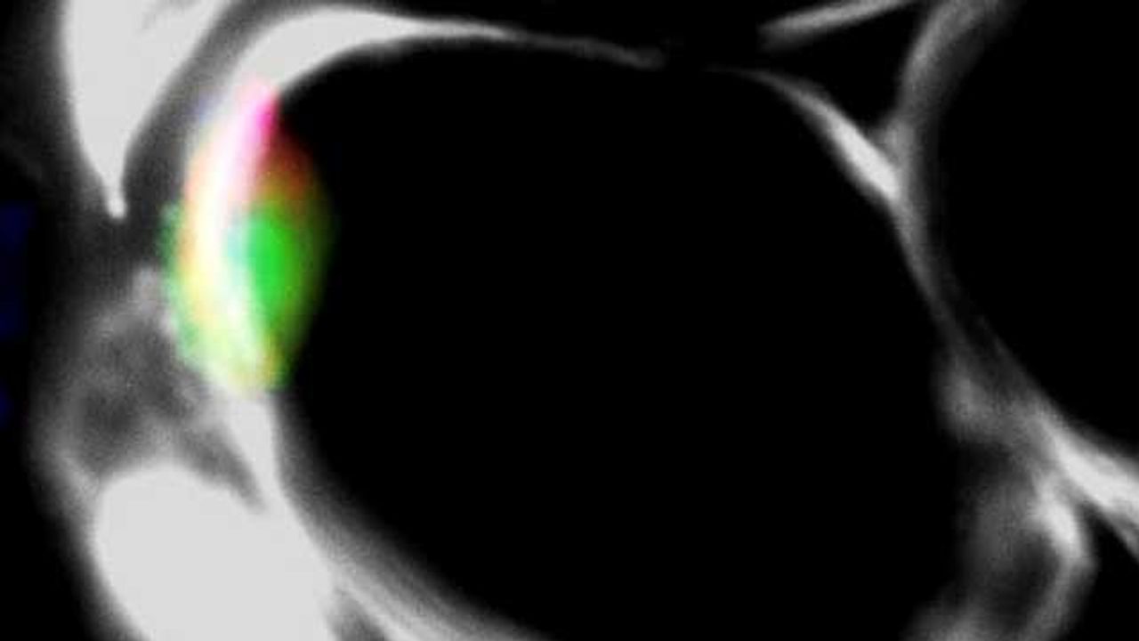 Lab-Grown, Self-Sustainable Muscle Cells Repair Muscle Injury in Mice
