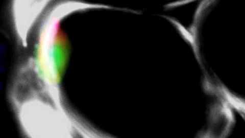 Lab-Grown, Self-Sustainable Muscle Cells Repair Muscle Injury in Mice
