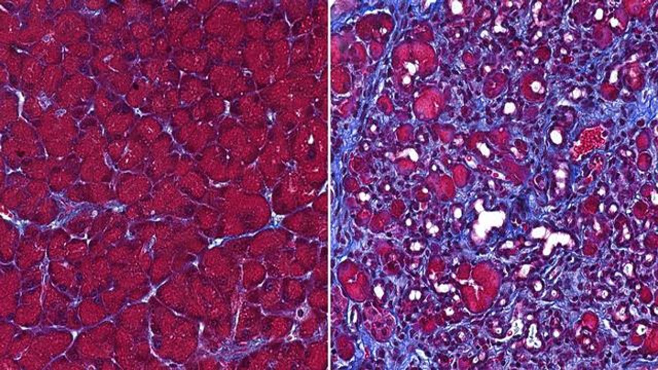 This Protein Stops the Pancreas From Digesting Itself