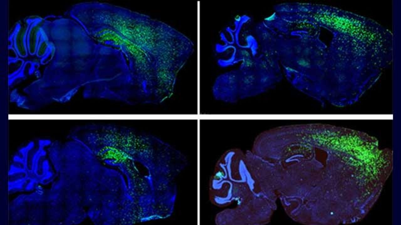 Autism Behaviors Linked to Astrocytes, Suggests Mouse Study