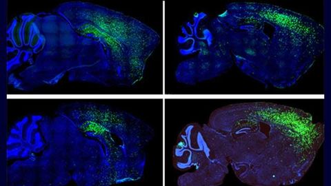 Autism Behaviors Linked to Astrocytes, Suggests Mouse Study