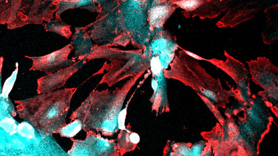 SARS-CoV-2 Can Directly Infect Human Kidney Cells content piece image