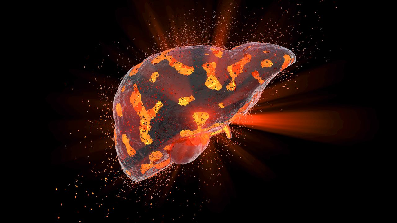 New Model Will Support Drug Discovery for Liver Disease NASH