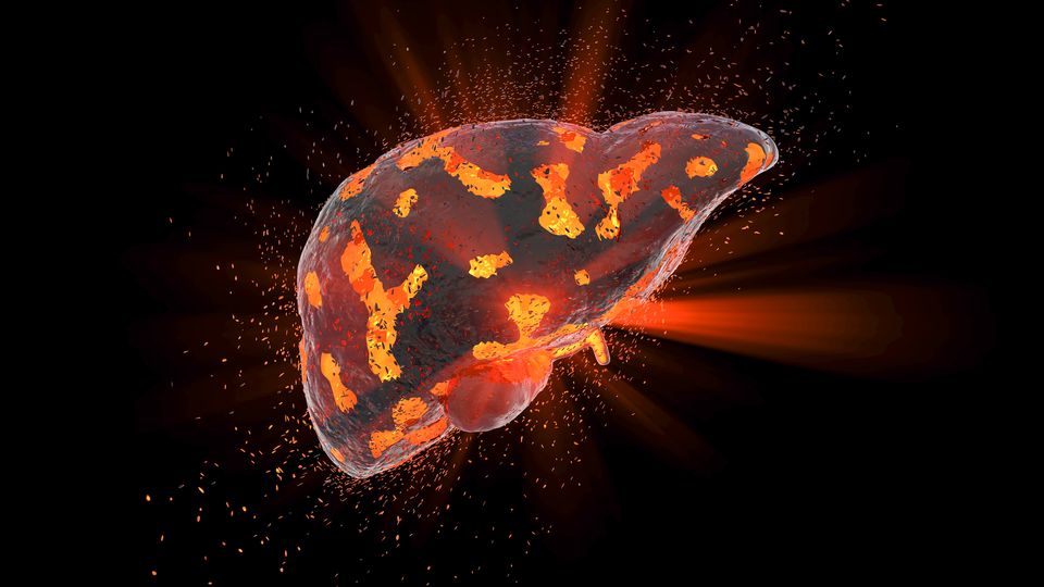 New Model Will Support Drug Discovery for Liver Disease NASH content piece image